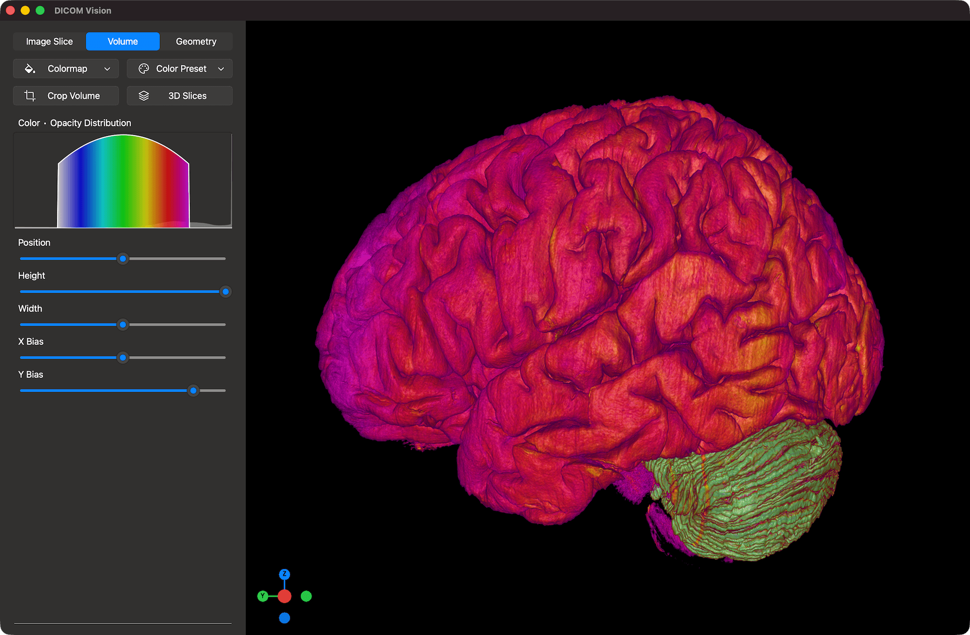 DICOM Vision 2 on Mac