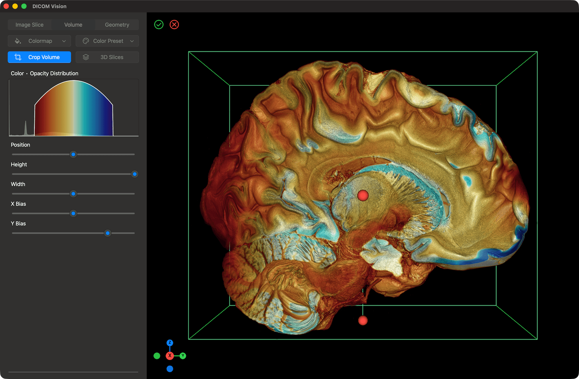 DICOM Vision 2 on Mac