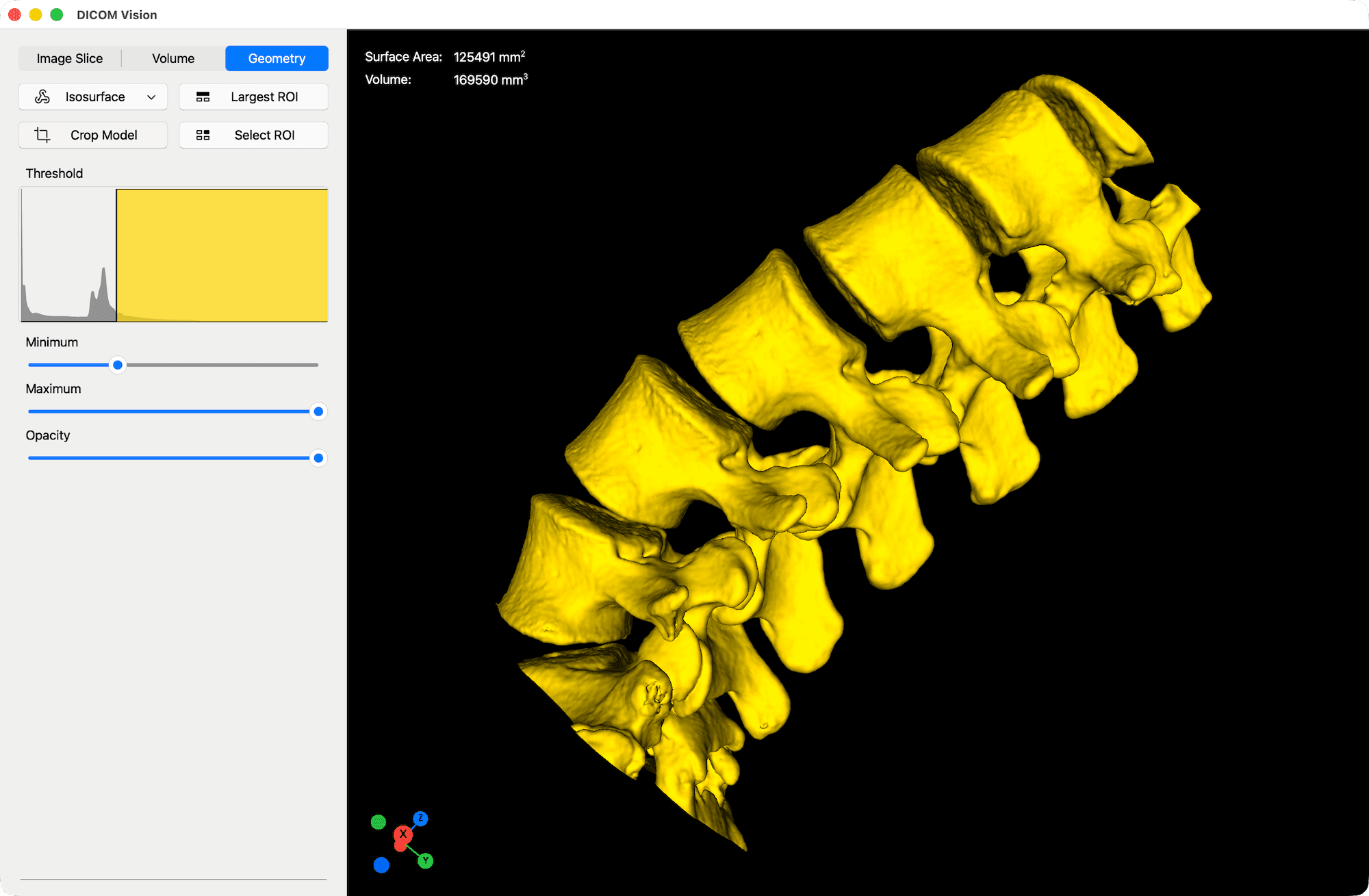 Isosurface - DICOM Vision