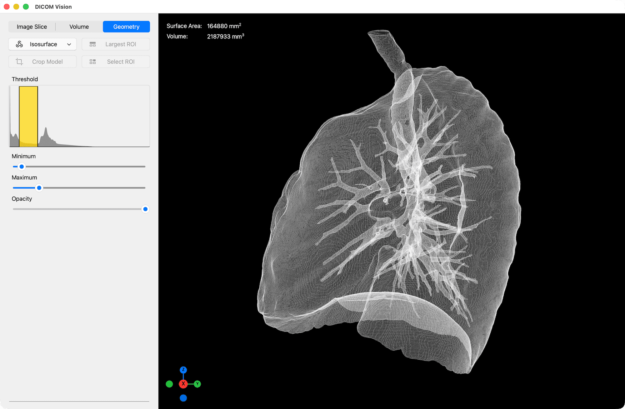 Wireframe View - DICOM Vision