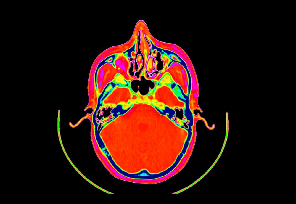 DICOM Image with Black Colormap Base