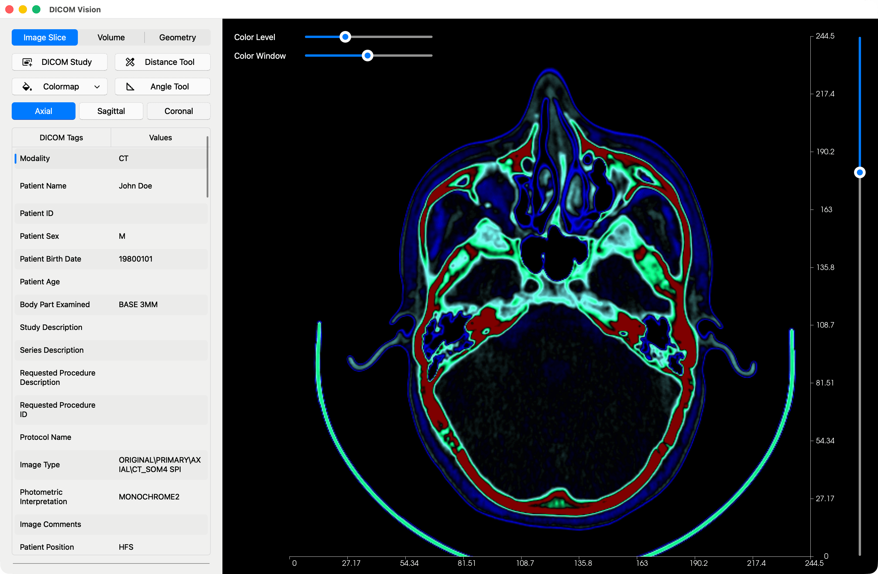 Color Level and Color Window adjustments on a DICOM Slice - DICOM Vision