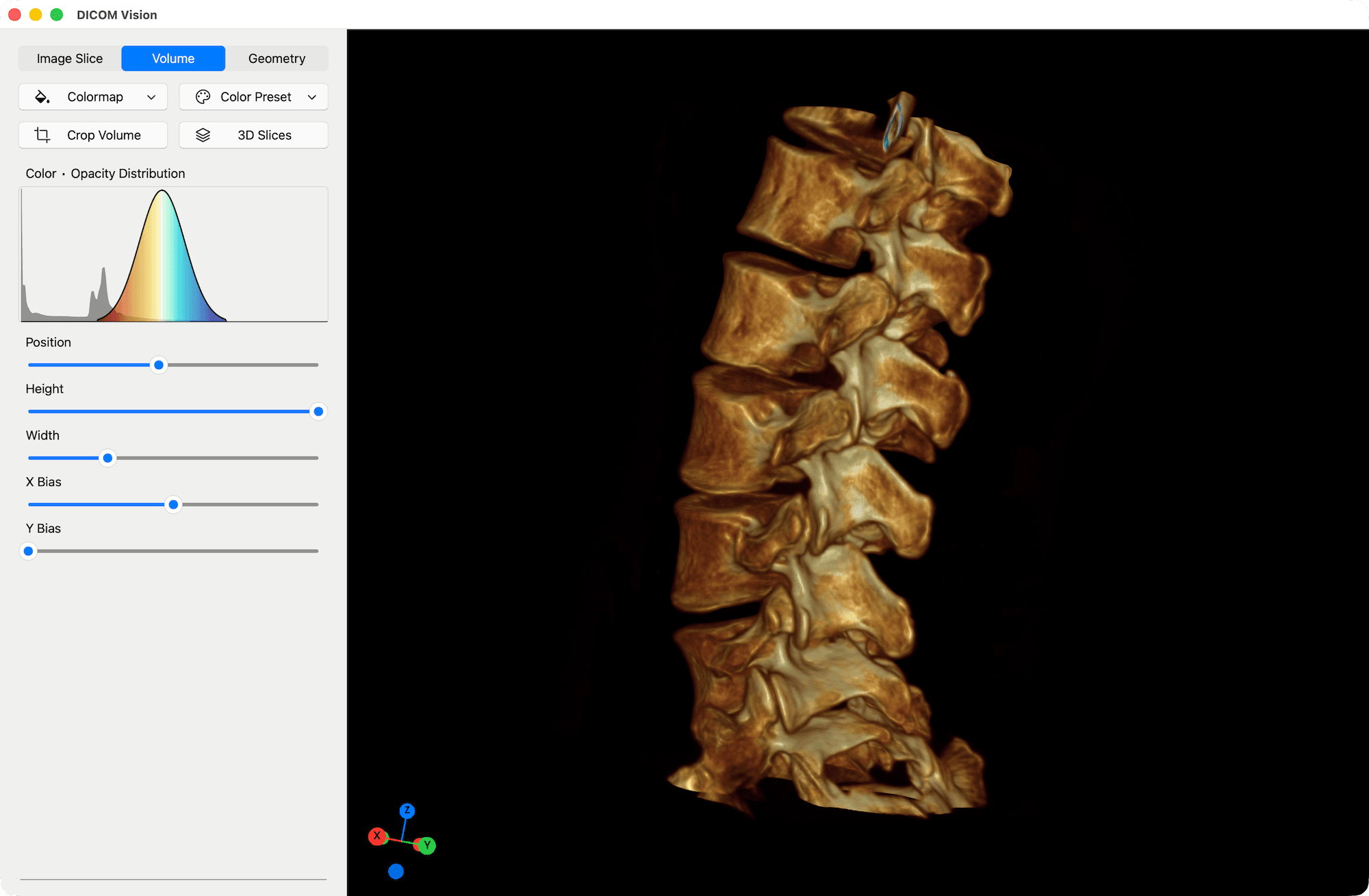Volumetric Colormap - DICOM Vision