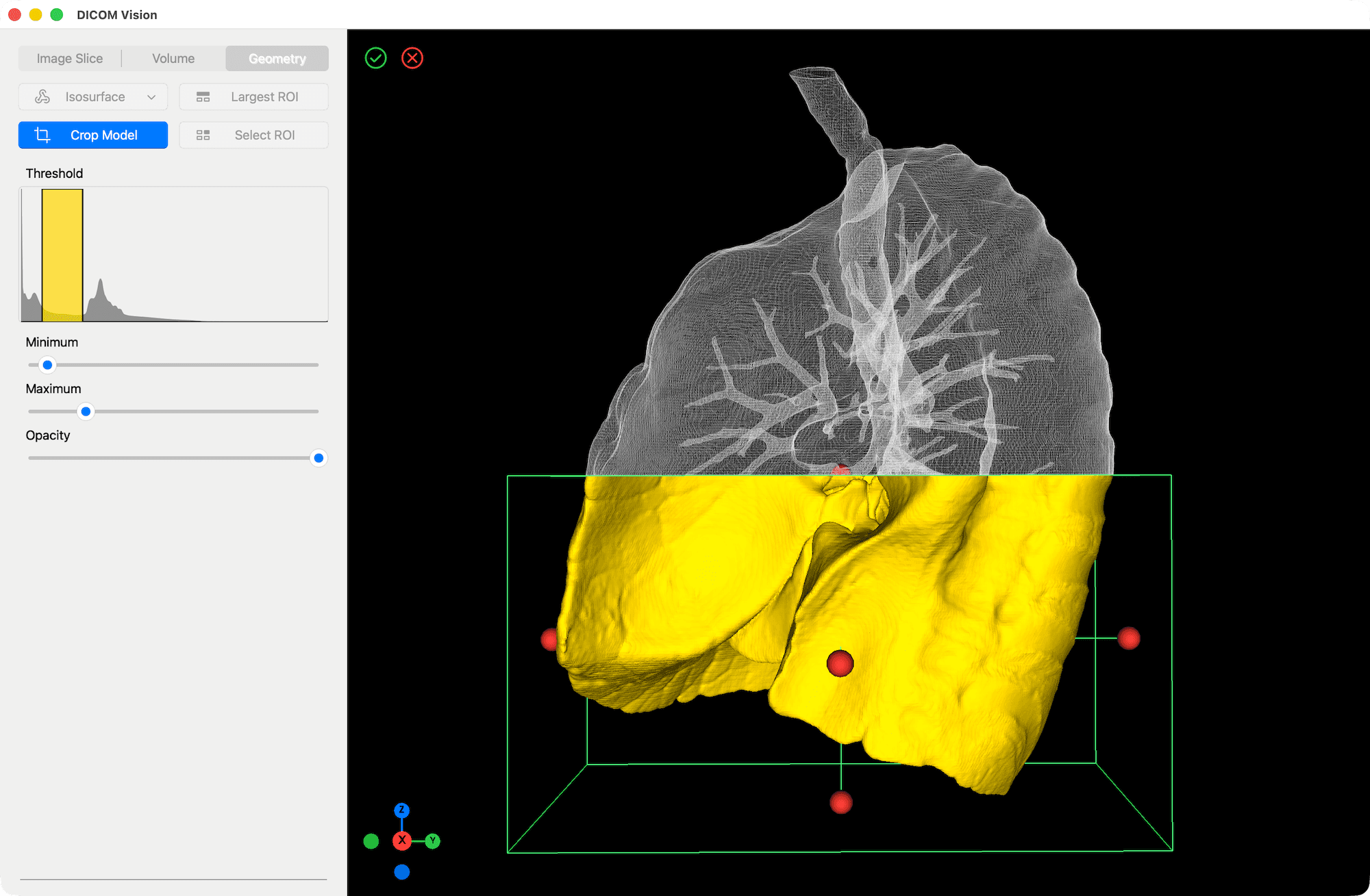 Crop Tool - DICOM Vision