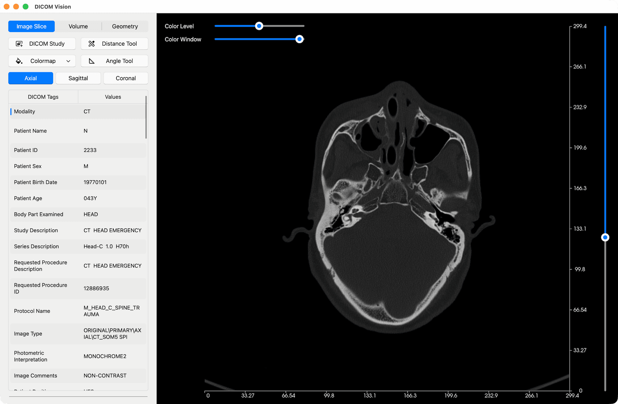Import DICOM Study Result - DICOM Vision