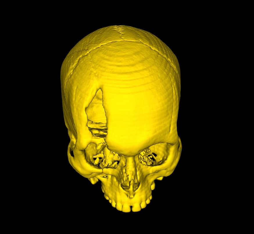 Crop with Open Edges - DICOM Vision