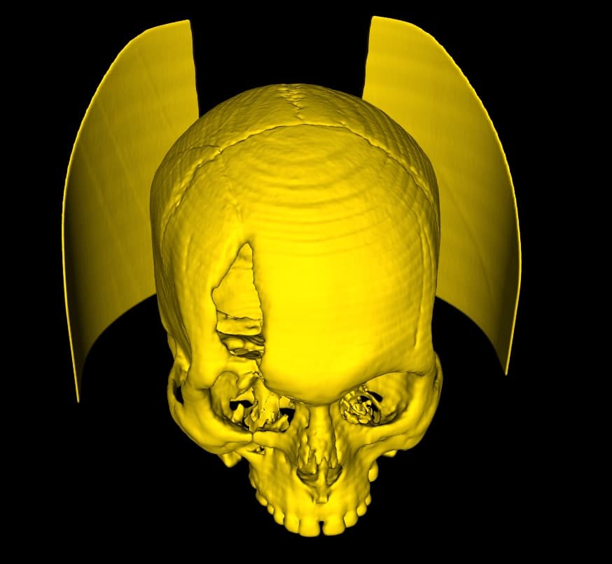 Crop with Closed Edges - DICOM Vision
