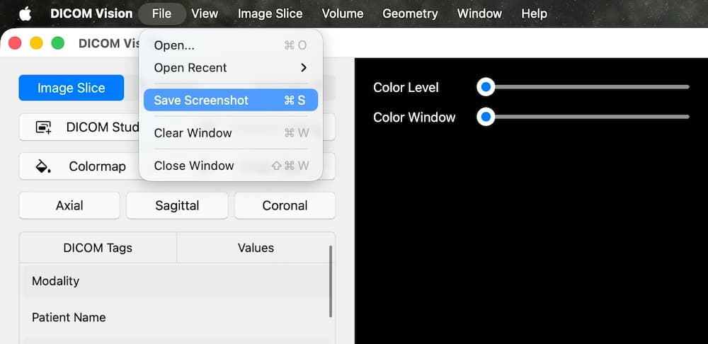 DICOM Vision macOS Interface