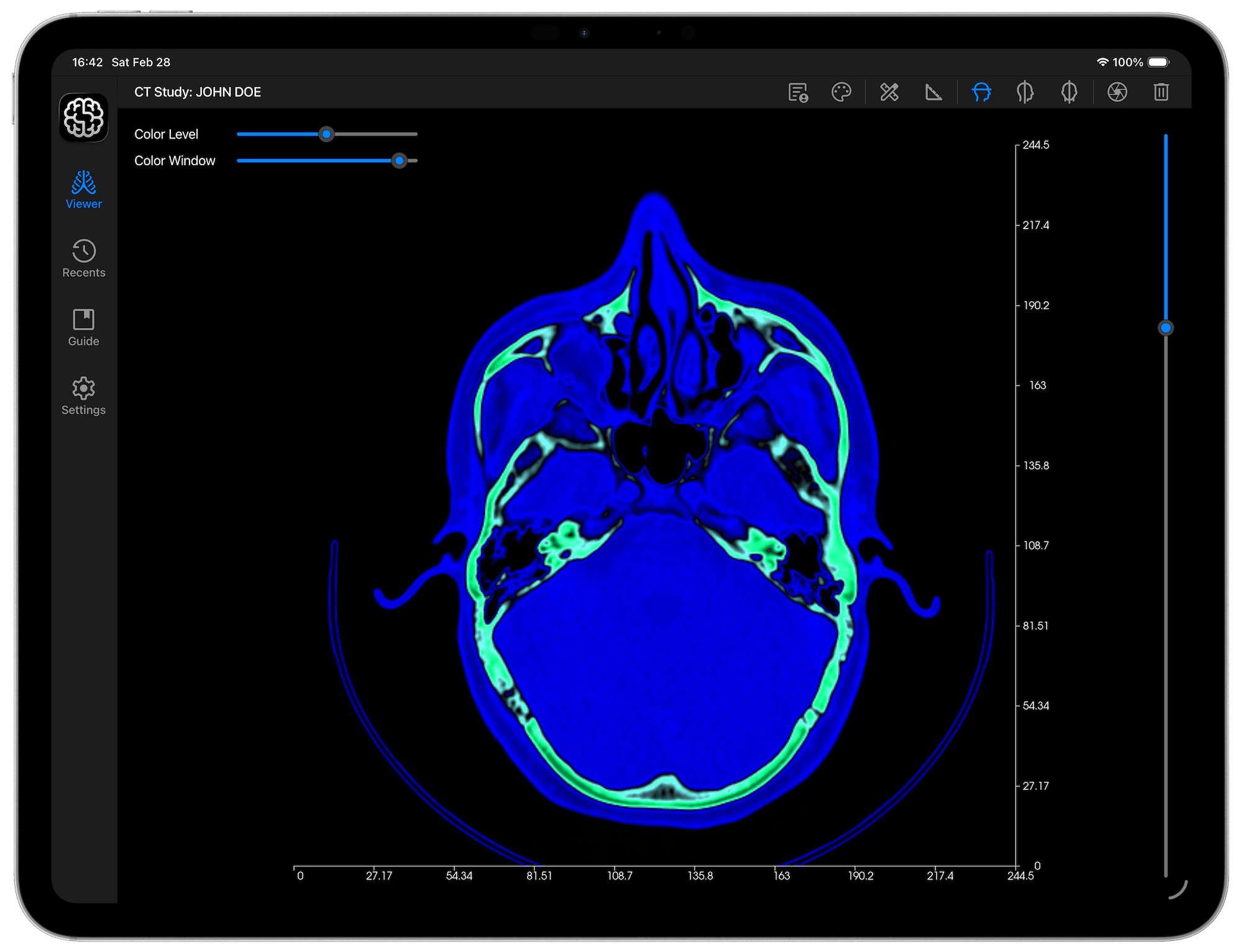 DICOM Vision Go on iPad - Before Colormap is Applied