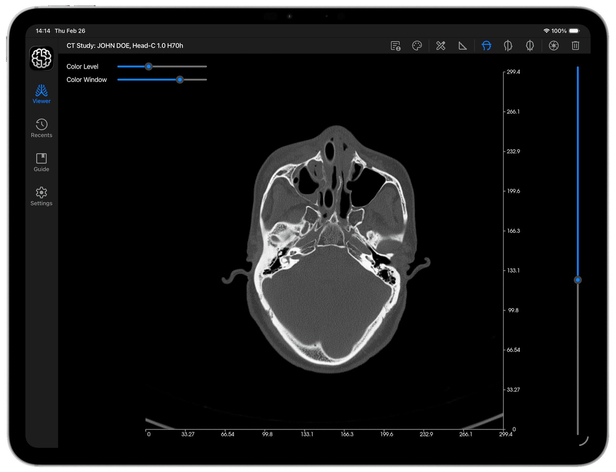 DICOM Vision Go on iPad - Select DICOM Folder (Landscape View)