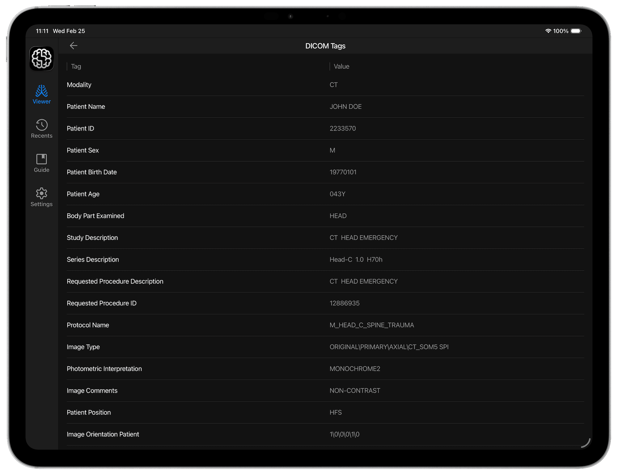 DICOM Vision Go on iPad - Select DICOM Folder (Landscape View)