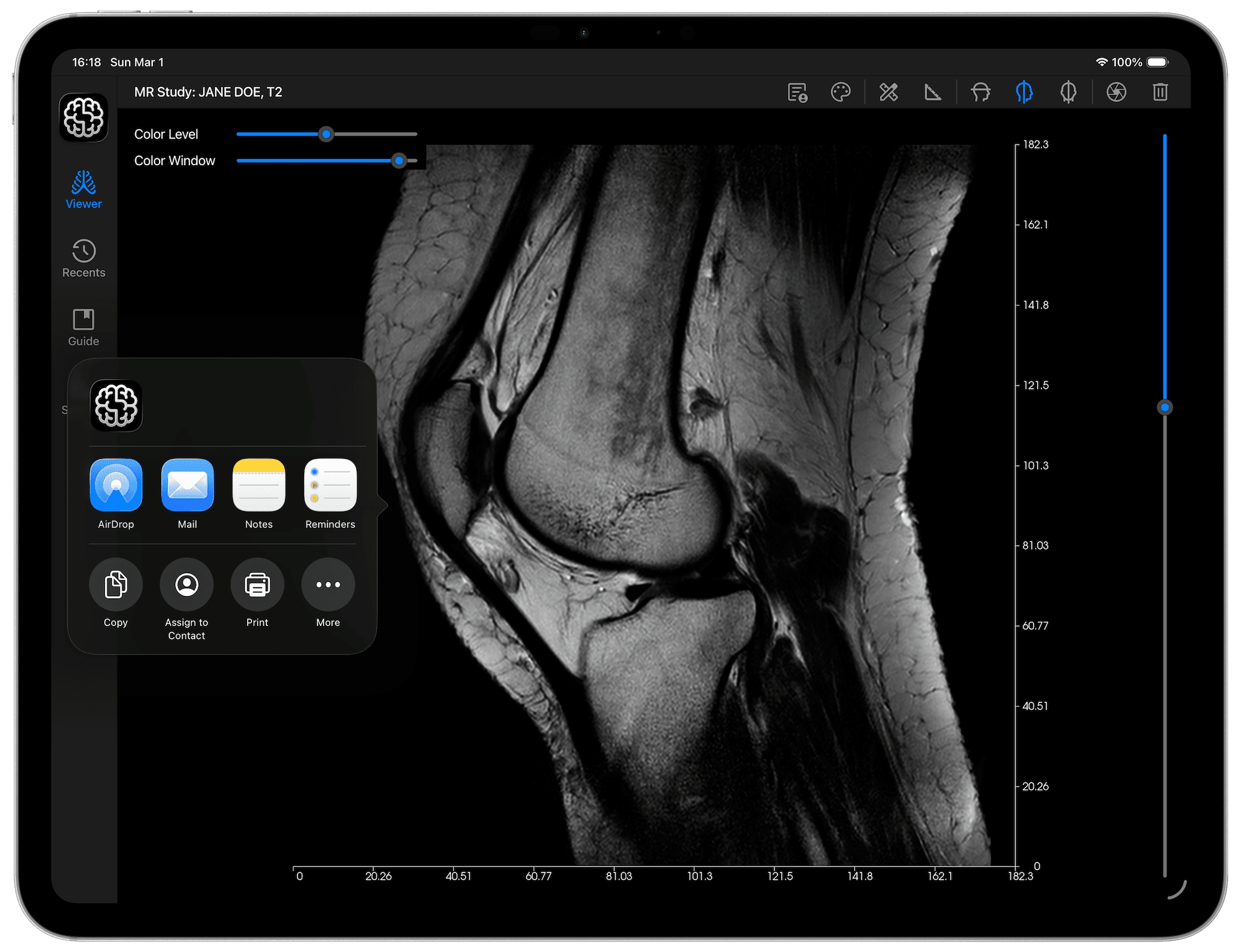 DICOM Vision Go on iPad - Share Screenshot