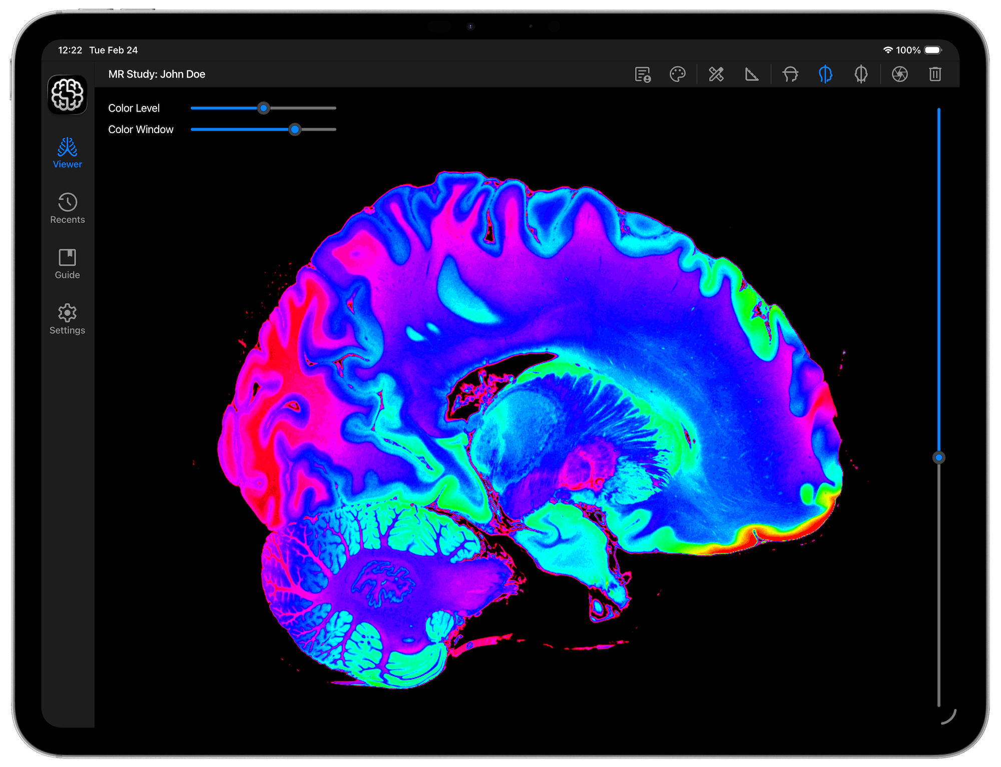 DICOM Vision Go on iPad