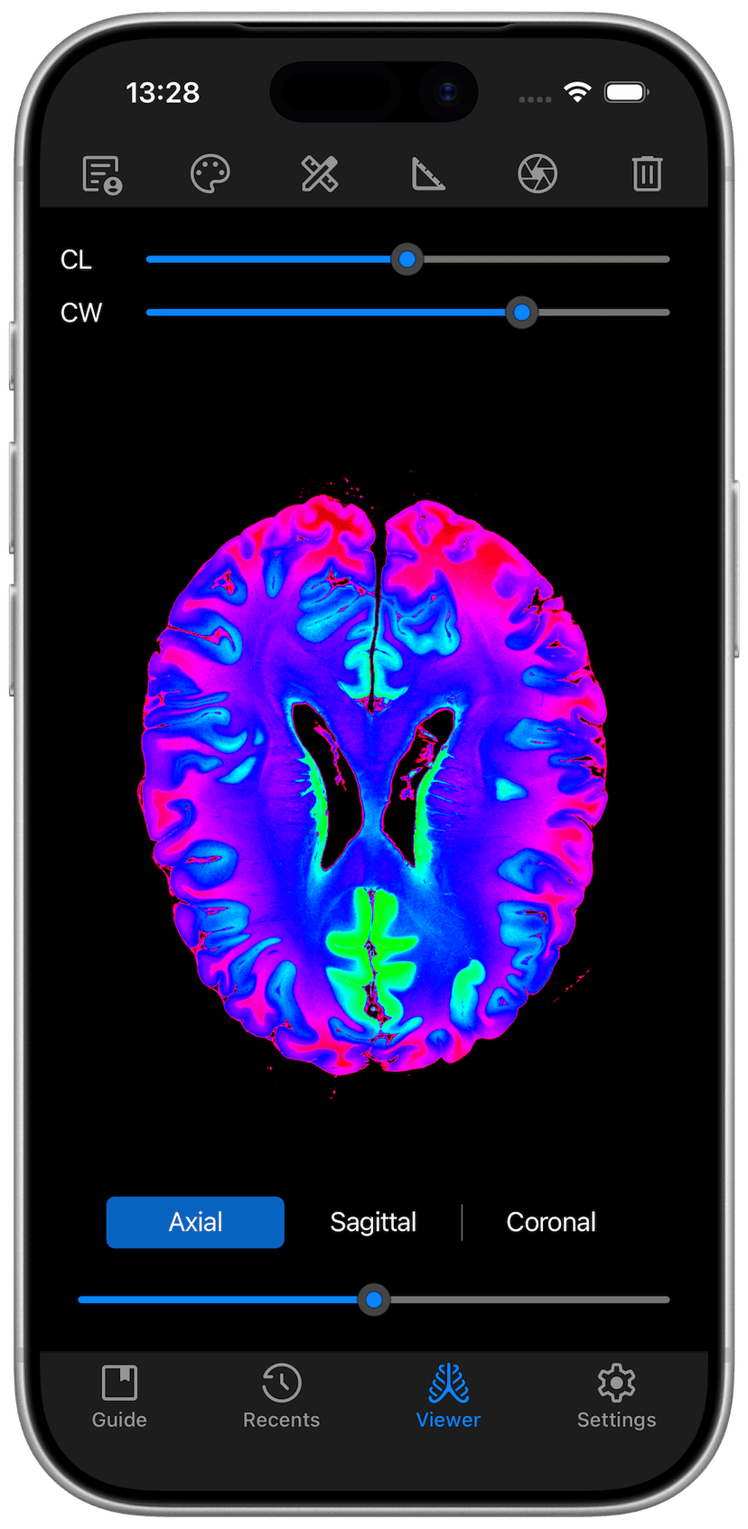 DICOM Vision Go on iPhone - Axial View