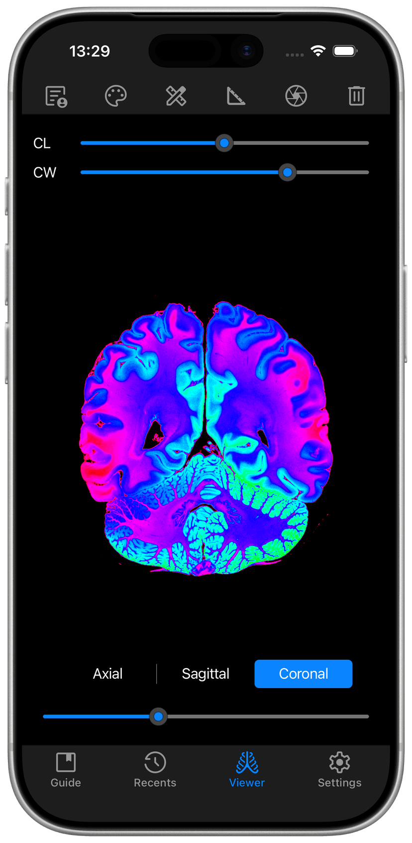 DICOM Vision Go on iPhone - Coronal View