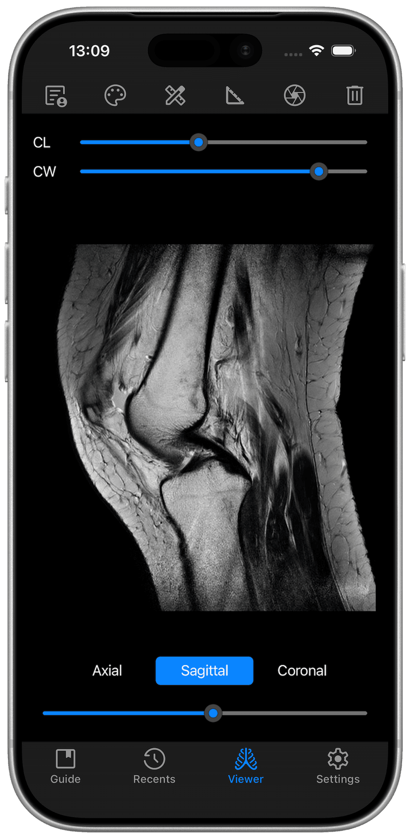 DICOM Vision Go on iPhone - Viewer