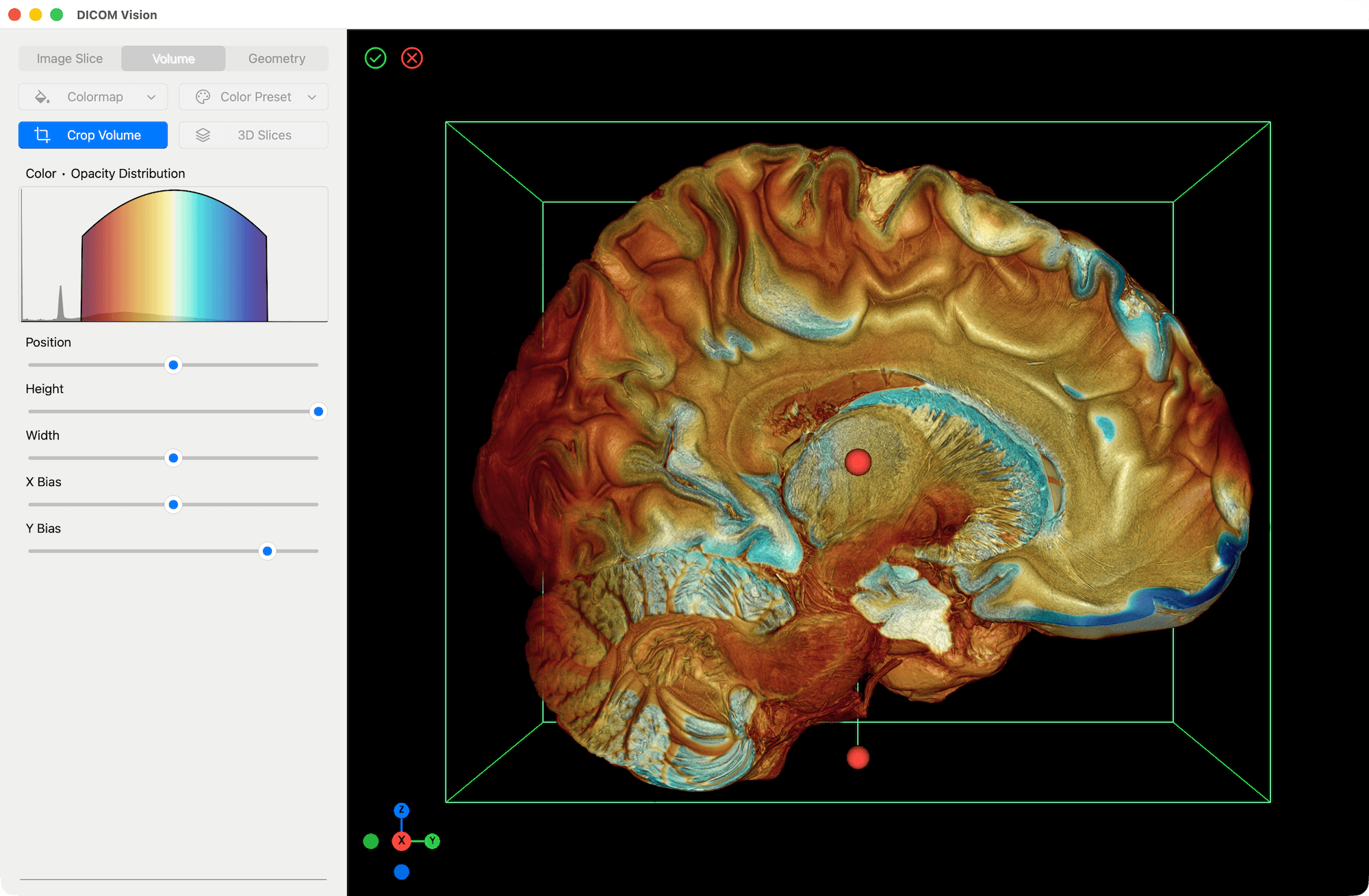 Cropping a Volume - DICOM Vision