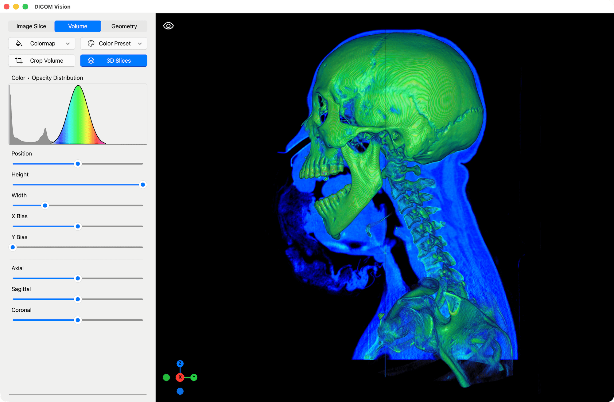 3D Slices - DICOM Vision